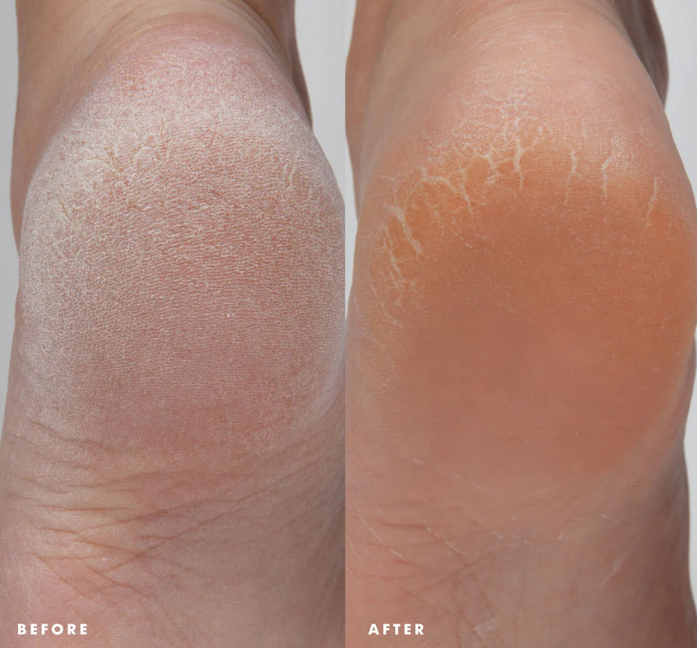 Enrich Mint Foot Rescue Mask