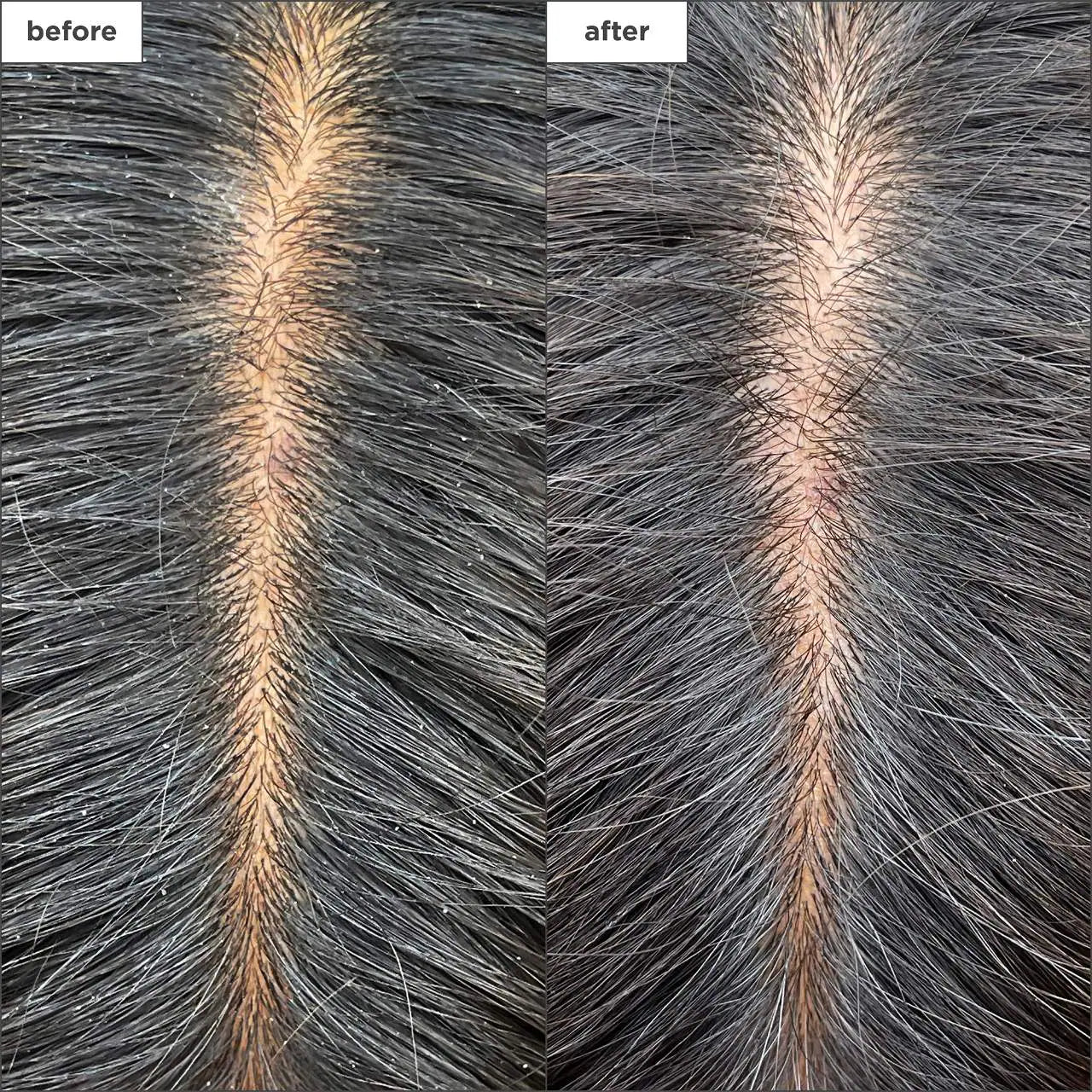 Briogeo Scalp Revival
